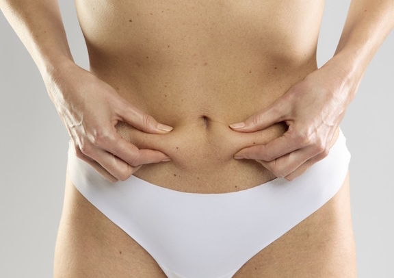 Bauchdeckenstraffung, Plastische und Ästhetische Chirurgie in Bochum, Ästhetik-Centrum